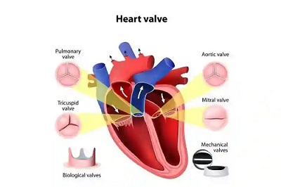 Valve Replacement and Repair